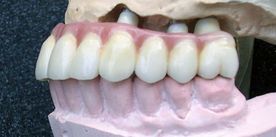 Centro de Prótesis Dentales El Pilar dientes prótesis