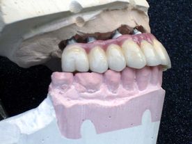 Centro de Prótesis Dentales El Pilar dientes